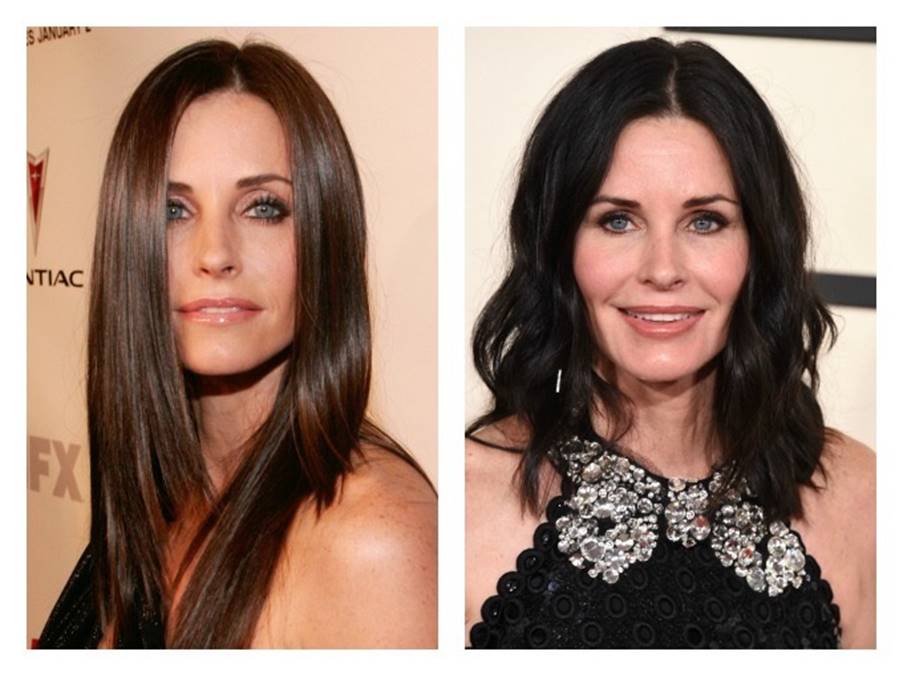 Courtney Cox’s Plastic Surgery