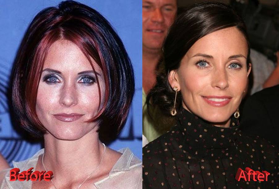 Courtney Cox’s Plastic Surgery